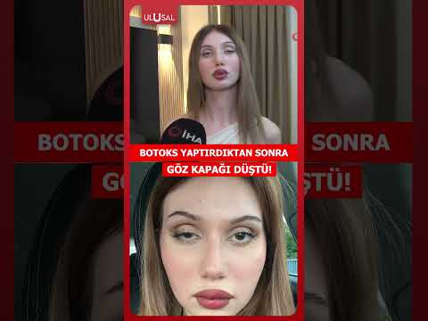 Düğününe 3 ay kala botoks yaptırdı! Hayatı cehenneme döndü! #shorts thumbnail