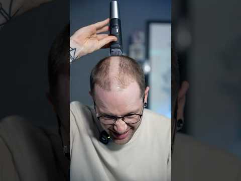 I Deleted My Hair… thumbnail