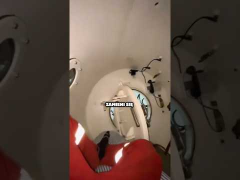Ten prosty zabieg ratuje im życie 😳 thumbnail