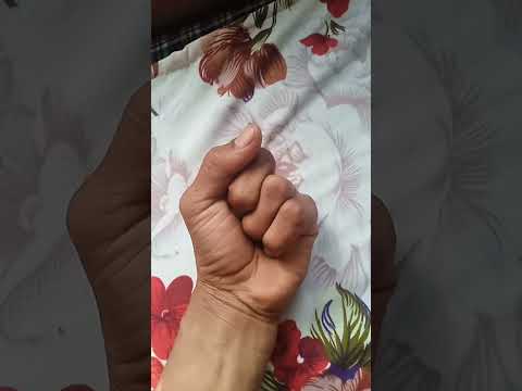 I have 4 fingers #shortvideo #youtubeshorts #shorts #newshorts thumbnail