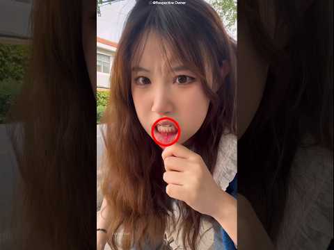 Girl Tries Eating Spicy Food With Mouth Ulcer 🌶️😖 #shots #facts thumbnail