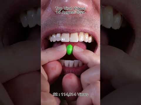 Satisfying Chewing ASMR #Compilation #ASMR #DoctorTristanPeh thumbnail