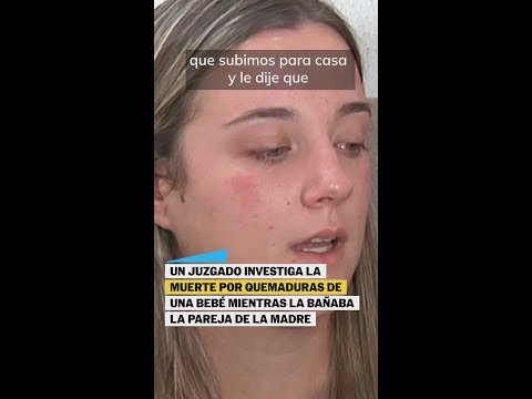 Habla la MADRE de la BEBÉ fallecida en Sevilla por quemaduras #shorts thumbnail