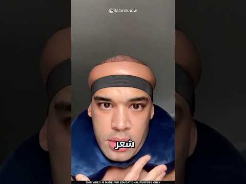 ما سر انتفاخ الرأس thumbnail