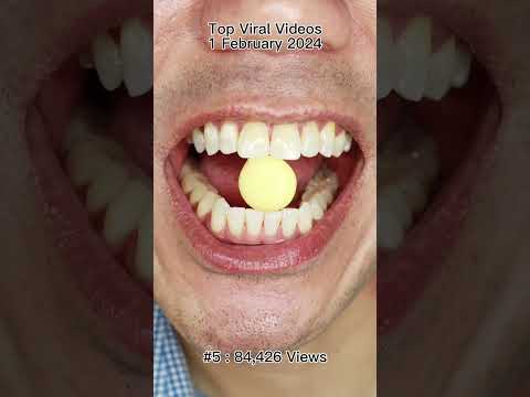 Satisfying Chewing ASMR #Compilation #ASMR #DoctorTristanPeh thumbnail