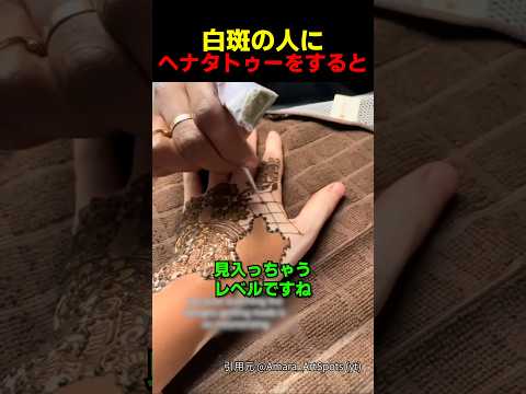 白斑の人にヘナタトゥーをすると thumbnail