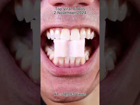 Satisfying Chewing ASMR #Compilation #ASMR #DoctorTristanPeh thumbnail