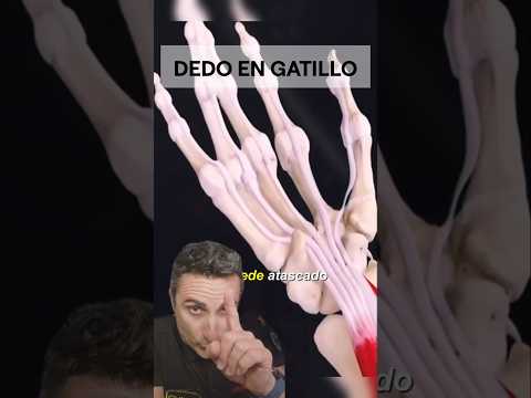 Dedo en gatillo.#supervivencia #curiosidades #sabiasque thumbnail