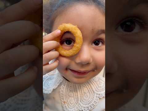Bilge senin gözün niye şişti😂 #aboneolmayiunutmayin #keşfetbeniöneçıkar #kesfeteyyiz #funny #shorst thumbnail