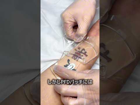 タトゥー除去を4倍効率的にするアイテム thumbnail