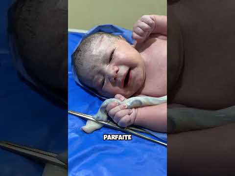 Le bébé a fait quelque chose qui a stupéfié tout le monde juste après sa naissance ! 😲 thumbnail