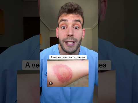 Garrapata; Síntomas que es importante que reconozcamos #primerosauxilios #ayuda #naturaleza thumbnail