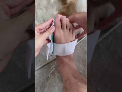 Adjustable Foot Care Big Toe Straightener ? thumbnail