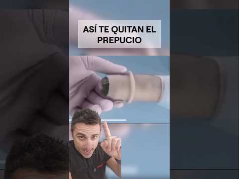Así te quitan el prepucio.#supervivencia #curiosidades #sabíasque thumbnail