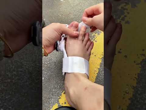 Adjustable Foot Care Big Toe Straightener ? If you've been ignoring it, this is your wake up call. thumbnail