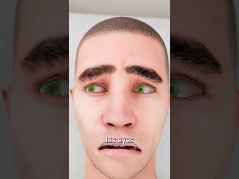 Paralyzed Artist Painted Using Only His Eyes 😢 thumbnail
