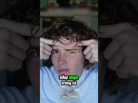 Thử Thách 30 Ngày Không Dùng Dầu Gội Và Cái Kết Chấn Động 😱 thumbnail
