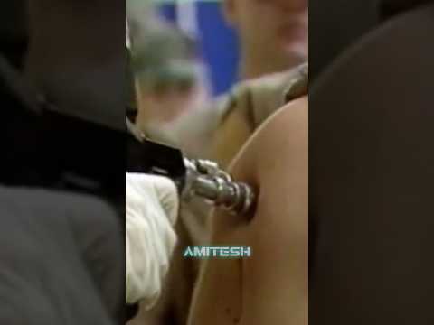 Иньектор высокого давления #амитеш #технологии thumbnail