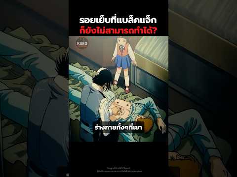 รอยเย็บที่แบล็คแจ็กก็ยังไม่สามารถทำได้? #สปอยอนิเมะ #อนิเมะ #anime #shorts thumbnail