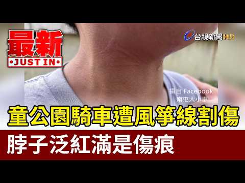 童公園騎車遭風箏線割傷 脖子泛紅滿是傷痕【最新快訊】 thumbnail