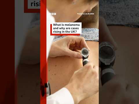 Melanoma skin cancer cases hit UK record high. #BBCNews thumbnail