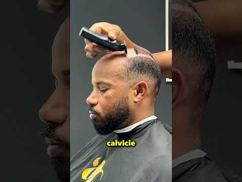 Este Chico Usa Cabello Postizo 😱 thumbnail