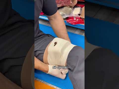 Đừng bao giờ làm điều này nếu có vật đâm vào người bạn ? thumbnail