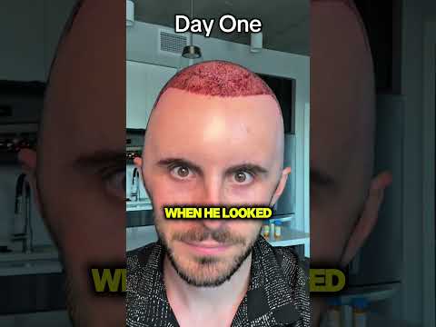 The Hair Treatment That Went Wrong thumbnail