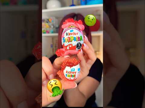 MINI comida ASQUEROSA vs TAMAÑO REAL🤮💚 #hellomon #juguetes #abriendojuguetes #minibrands thumbnail