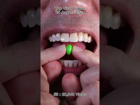 Satisfying Chewing ASMR #Compilation #ASMR #DoctorTristanPeh thumbnail