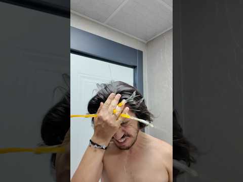KAFAMDA YUMURTA KIRDIM 🥚 thumbnail