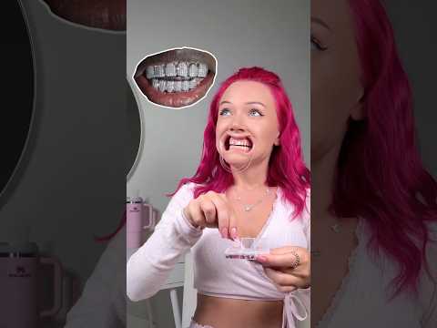 I made diamond teeth😬🤩 Real or fake?) thumbnail