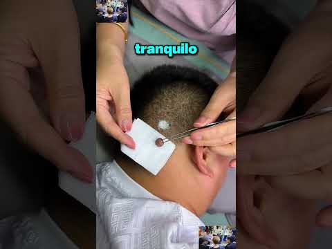 Le Aterraba Que Le Quitaran el Grano… Pero la Enfermera Lo Hizo en Segundos ? thumbnail