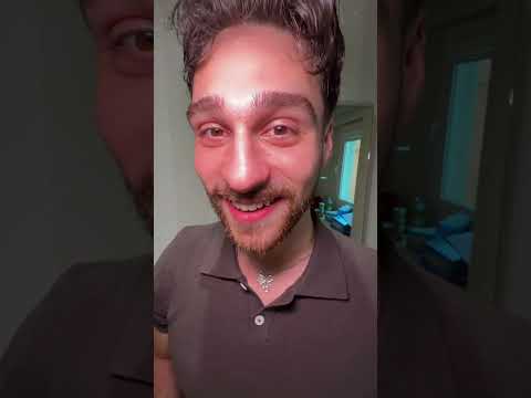Porfin encontré el glitter dumpling thumbnail