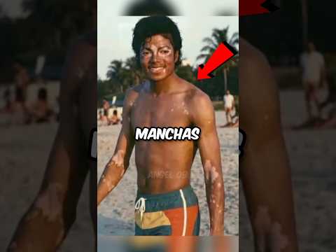 LA VERDAD DETRÁS DEL CAMBIO DE PIEL DE MICHAEL JACKSON thumbnail