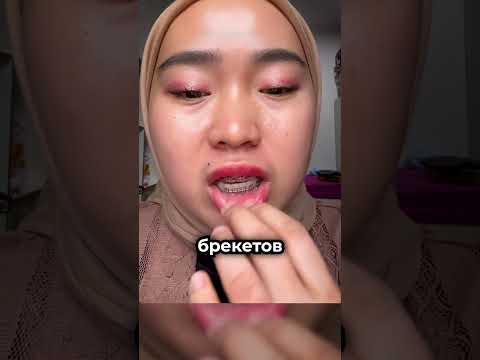 Никогда не сыпьте соль прямо на язву ? thumbnail