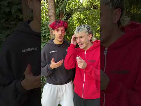 Mi AMIGO me OPERA el OJO para no QUEDARME CIEGO! thumbnail