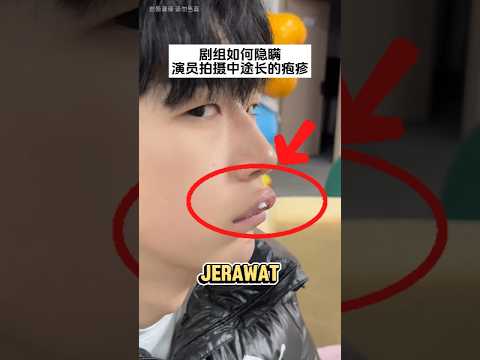 GARA-GARA JERAWAT… SEMUA JADI NGACO!!! ? thumbnail