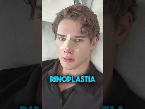 Streamer Clavicular transmite en vivo su rinoplastia quirúrgica por Kick 😱🤔 #Shorts thumbnail