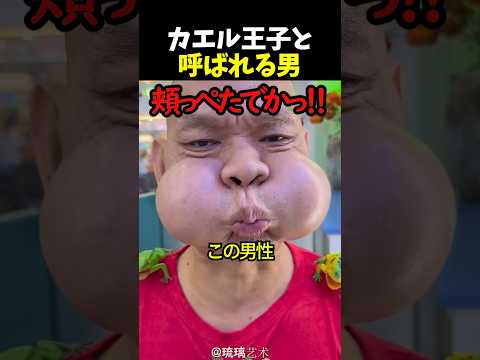 カエル王子と呼ばれる男 thumbnail