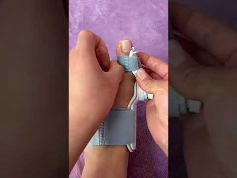 How to Correct Toe Deformity at Home ( # 2115 ) ▶️ Adjustable Foot Care Big Toe Straightener thumbnail