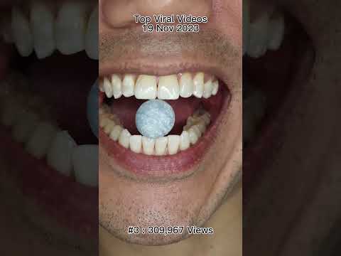 Satisfying Chewing ASMR #Compilation #ASMR #DoctorTristanPeh thumbnail