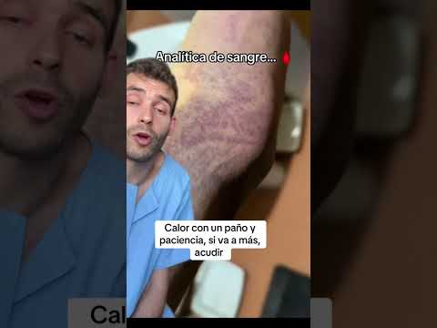 Suele ser raro pero puede pasar #datoscurisos #sabiasque #enfermeria thumbnail