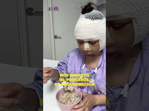 ¡ASÍ QUEDÓ PUGUM WISAD, LA CHICA QUE SE SOMETIÓ A UNA CIRUGÍA EXTREMA PARA CAMBIAR SU ROSTRO! thumbnail