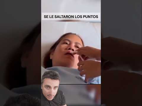 Se le saltaron los puntos.#supervivencia #curiosidades #sabiasque thumbnail