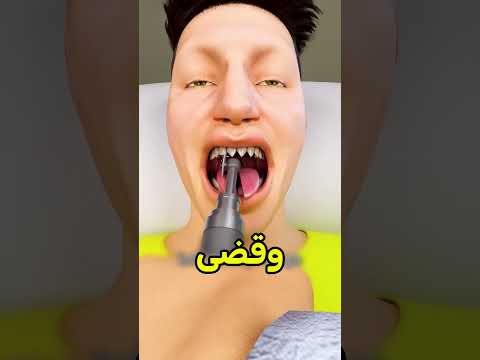 حول نفسه لسحلية و ندم عليها 😨 #shortvideos thumbnail