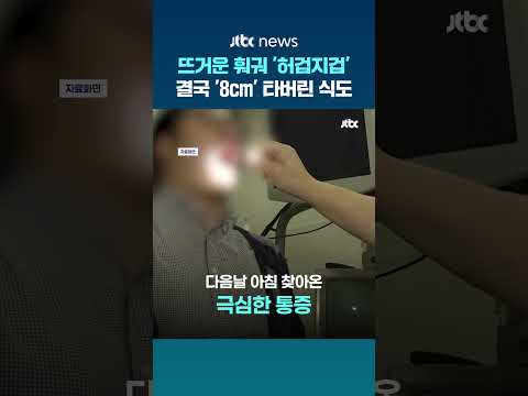뜨거운 훠궈 '허겁지겁' 먹은 중국 여성…결국 '8cm' 타버린 식도 #JTBC #Shorts thumbnail