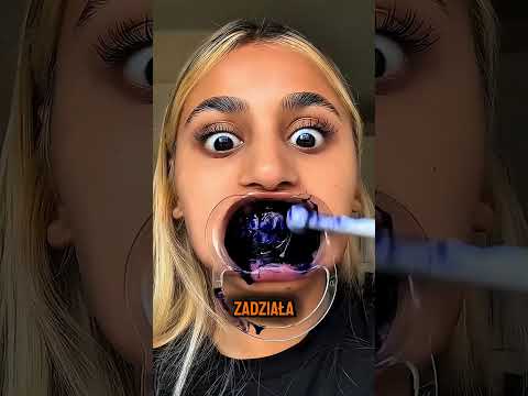Dziewczyna Zniszczyła Sobie Zęby Przez Wybielanie 😨 thumbnail