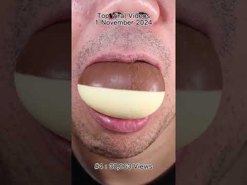 Satisfying Chewing ASMR #Compilation #ASMR #DoctorTristanPeh thumbnail