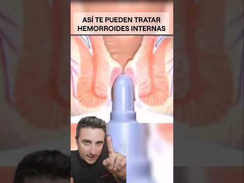 Así te pueden tratar las hemorroides.#supervivencia #curiosidades #sabiasque thumbnail